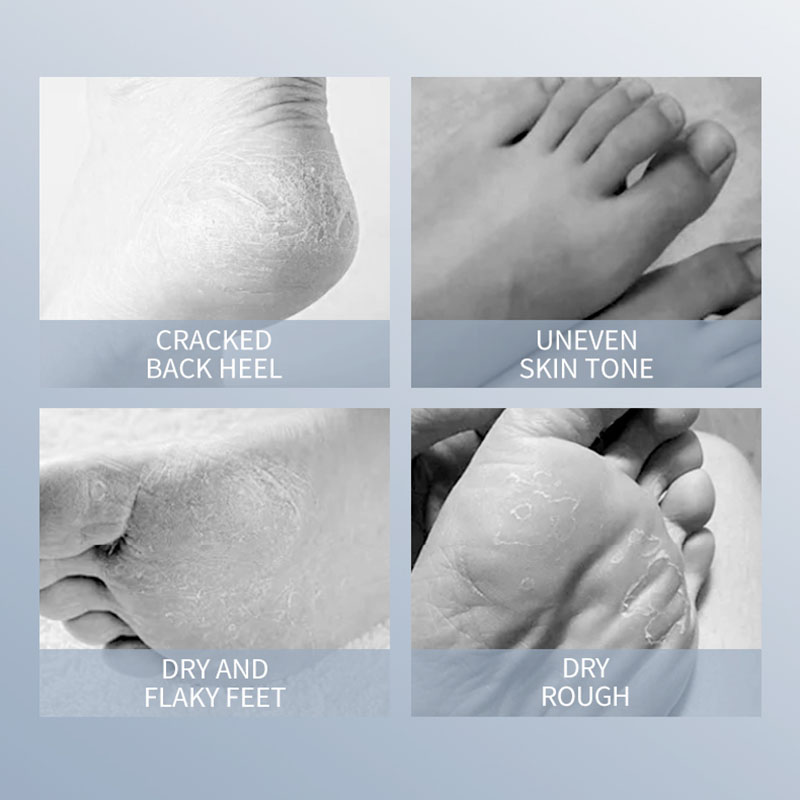 SADOER Ziegenmilch Fußmaske Fe – Foot Mask Peeling Bewertung und Preis