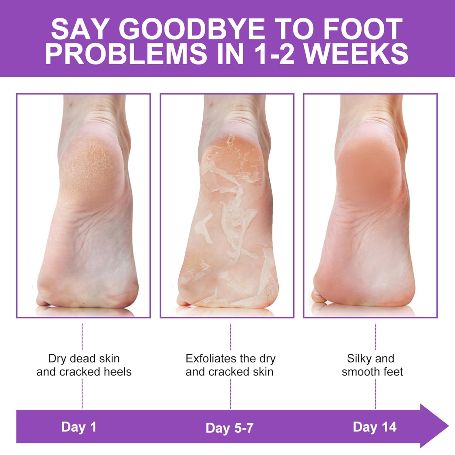Exfolierende Peeling-Socken zu – Foot Mask Peeling Bewertung und Preis