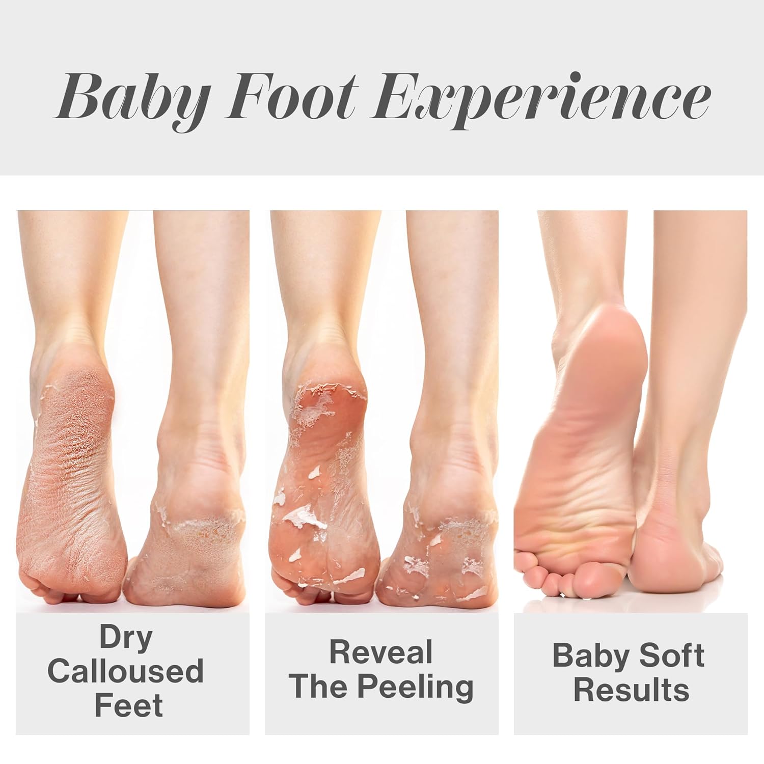 Exfolierende Peeling-Socken zu – Foot Mask Peeling Bewertung und Preis